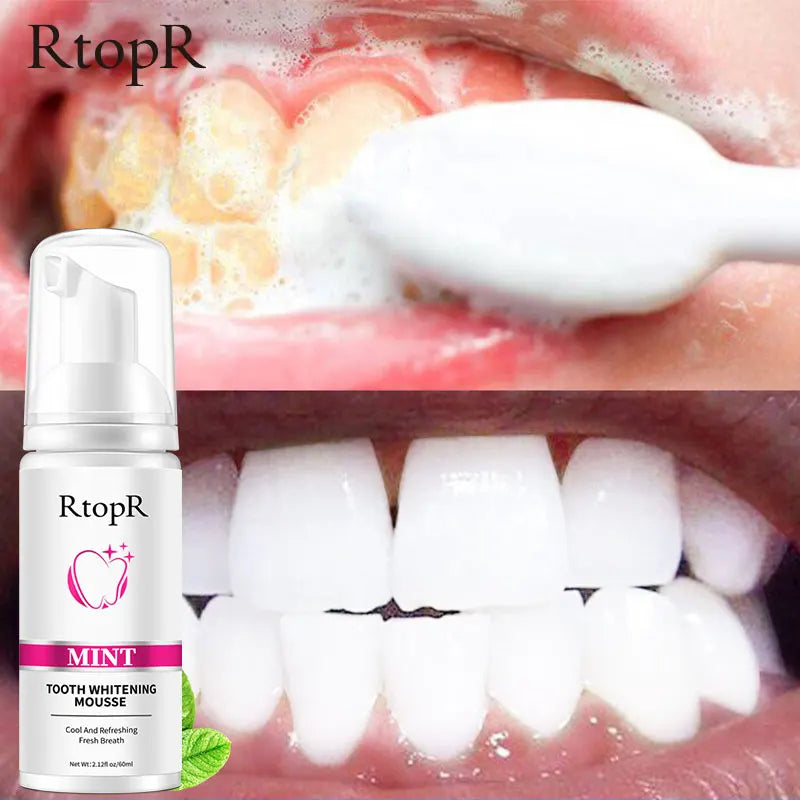 RtopR Teeth Cleansing Whitening Mousse